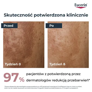 Eucerin Anti-Pigment, serum o podwójnym działaniu z Thiamidolem, przeciw przebarwieniom, 30 ml