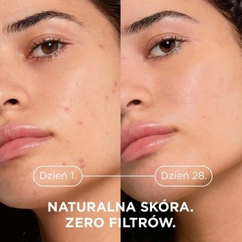 Bioderma Sebium Kerato+, żel-krem przeciwtrądzikowy, 30 ml