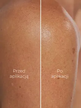 Swederm Gel Trap, nawilżający balsam do ciała w żelu, 250 ml