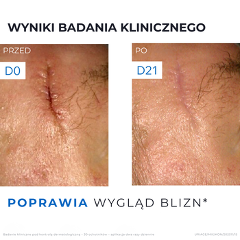 Uriage Bariederm CICA, krem regenerujący z Cu-Zn, 40 ml