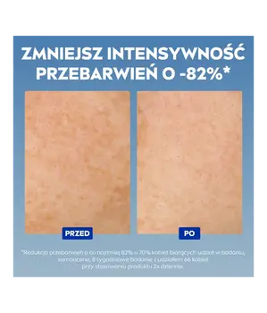 Nivea Cellular Luminous 630, zaawansowane serum na przebarwienia, 30 ml