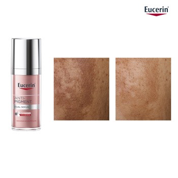 Eucerin Anti-Pigment, serum o podwójnym działaniu z Thiamidolem, przeciw przebarwieniom, 30 ml