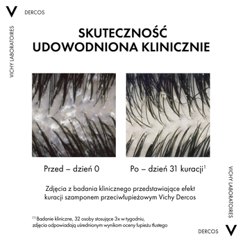 Vichy Dercos DS, szampon przeciwłupieżowy, włosy normalne i przetłuszczające się, 200 ml