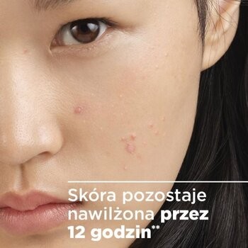 Bioderma Sebium Sensitive, łagodzący krem wspomagający leczenie skóry trądzikowej, 30 ml