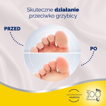 Scholl zestaw na grzybicę stóp, aplikator 4 ml + spray do obuwia 10 ml