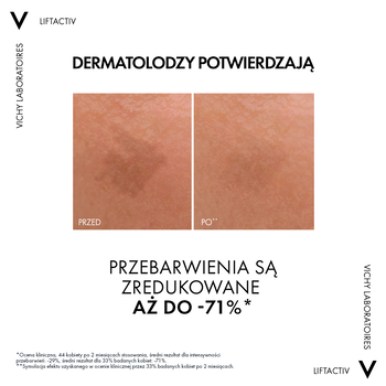 Vichy Liftactiv Specialist B3,serum redukujące przebarwienia i zmarszczki, 30 ml