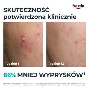 Eucerin Dermopure Clinical, serum o potrójnym działaniu, 40 ml