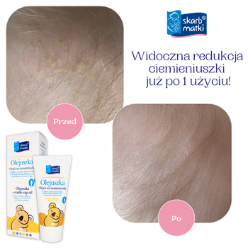 Skarb Matki, Olejuszka, olejek na ciemieniuszkę, 30 ml